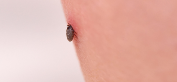 Top 6 Ingredients for Elite Immunity Support for Tick Diseases