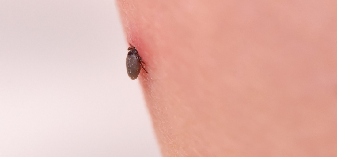 Top 6 Ingredients for Elite Immunity Support for Tick Diseases